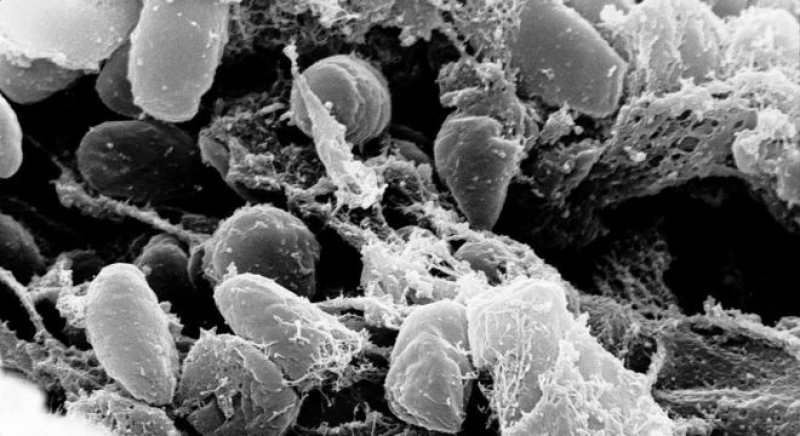 Caso de peste bubônica na China: existe risco de pandemia?